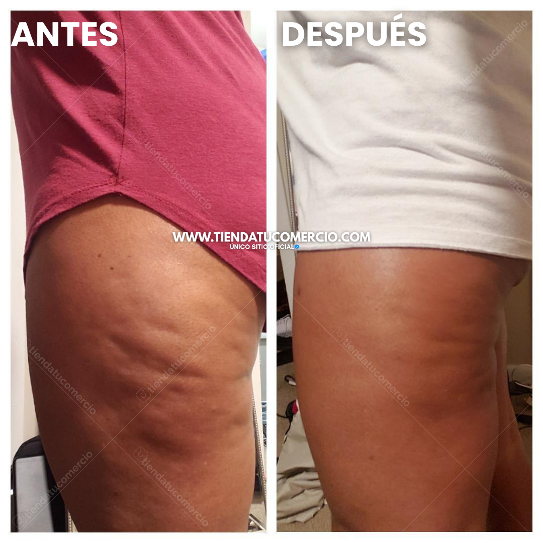 SuperOil: Gotas de Aceite con colágeno y células madre transformadoras 240ML