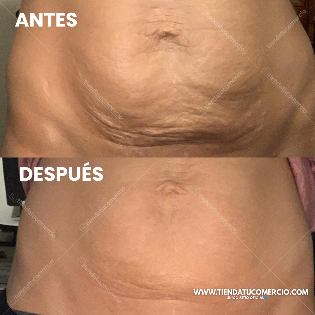 SuperOil: Gotas de Aceite con colágeno y células madre transformadoras 240ML