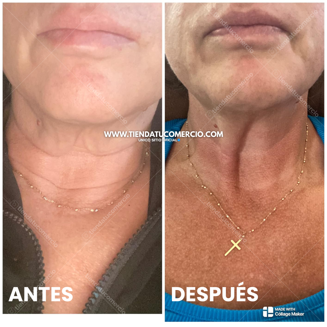 SuperOil: Gotas de Aceite con colágeno y células madre transformadoras 240ML