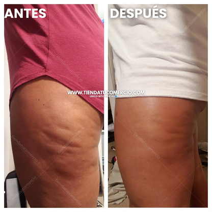 SuperOil: Gotas de Aceite con colágeno y células madre transformadoras 240ML